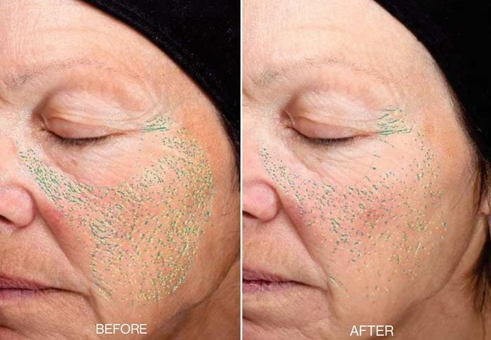 Die erste lymphatische Hautpflege der Welt: IRAYE Skincare 16 IRAYE PR ClinicalResults