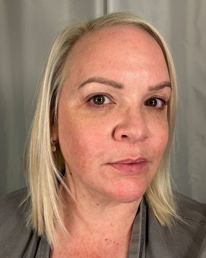 Currentbody LED Nachher