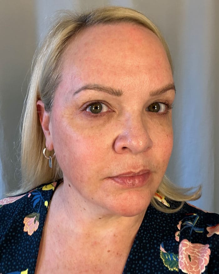 Currentbody LED Vorher