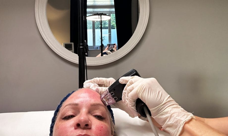 Exosome Treatment bei Dr. Haroon: Der grosse Erfahrungsbericht auf Hey Pretty Schweiz