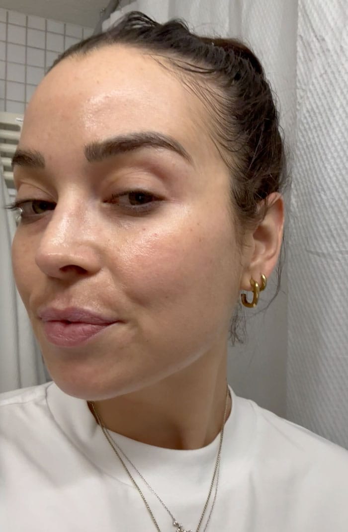 Besser als Morpheus8? Wir testen das Vivace RF Microneedling bei everskin 10 everskin vivace treatment nachher fazit 1